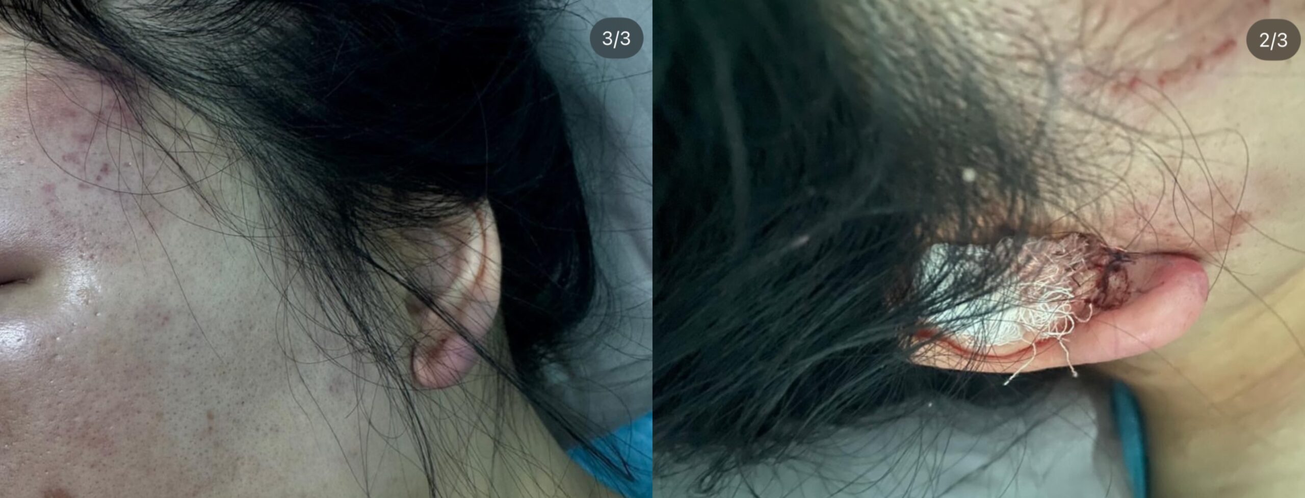 Шымкентте зорлыққа ұшыраған қыздың жарақатын сот-медициналық сараптама "жеңіл" деп бағалаған (ВИДЕО)