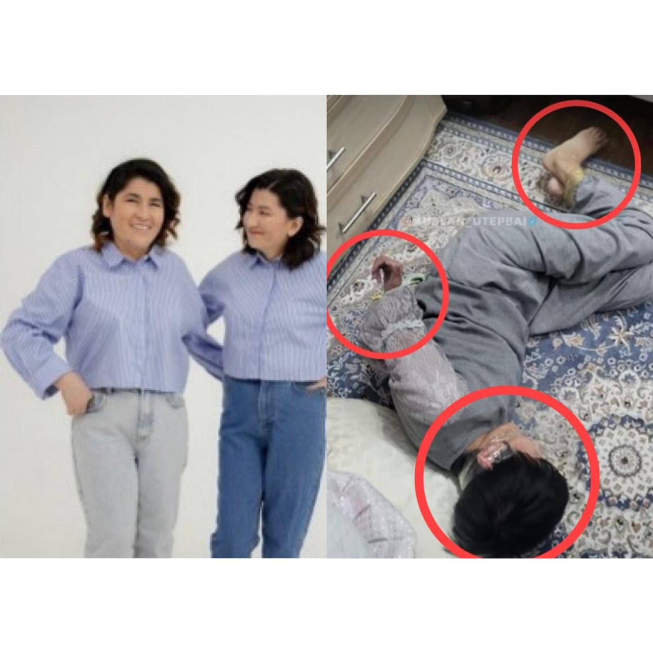 “Назгүлді ұрған”: Желіде 17 жыл құлдықта болған Құндыздың адамшошырлық фотосы тарады