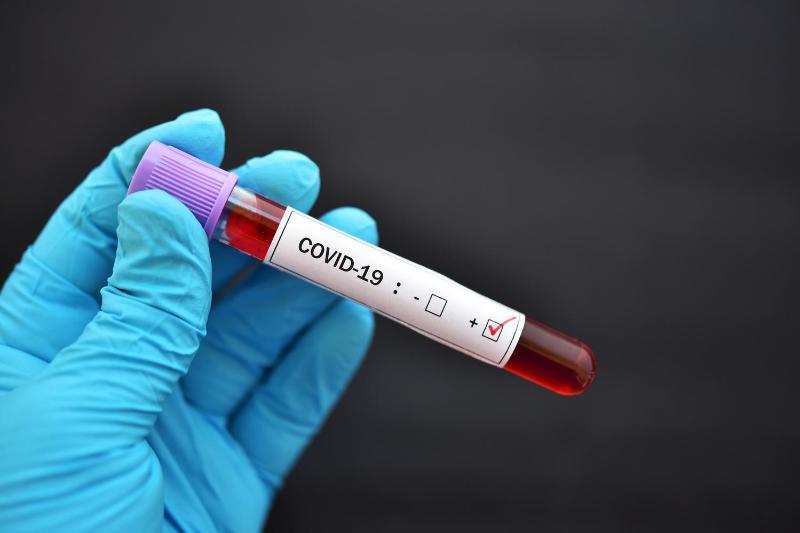 Теңіз кенішінде бір тәулікте 144 жұмысшыдан коронавирус анықталды